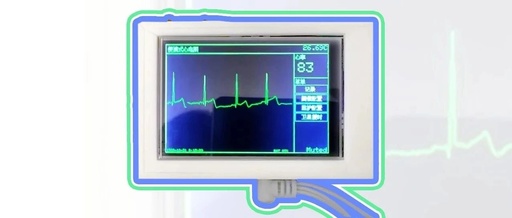 Portable ECG Machine Using ESP32 - Open Source Project