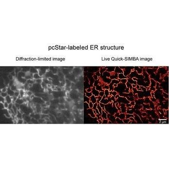 Fast Super-Resolution Imaging Technique for Live Cell Dynamics