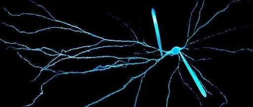 How Human Neurons Work Like Microcomputers: Key Structural Differences Revealed