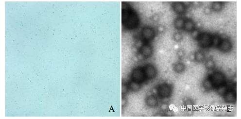 Inhibition of Breast Cancer Cells by Novel Nanoparticles Combined with Low-Intensity Focused Ultrasound