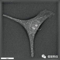 Monitoring Pyroptosis in B16 Cells Using Holographic 3D Imaging