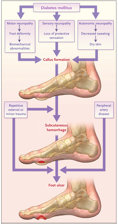 Current Research Status of Diabetic Foot Protection Techniques and Foot Aids