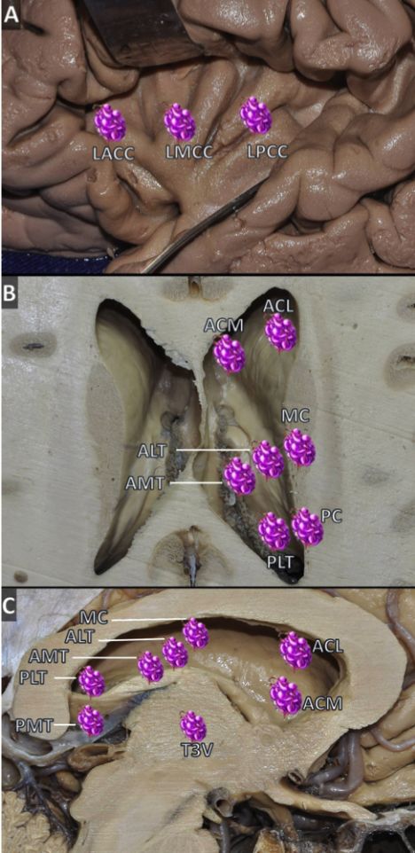 The Anatomical Significance of Brain White Matter Tracts