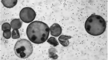 Algae-Based Antitumor Microbots