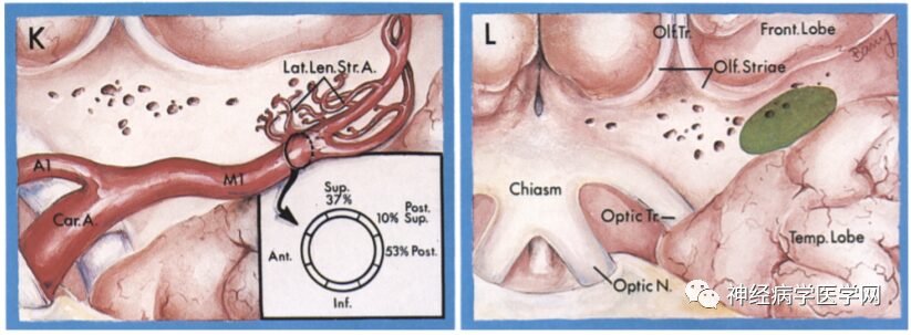 Types of Infarction in Perforating Artery Disease and Advances in Neuroimaging Research
