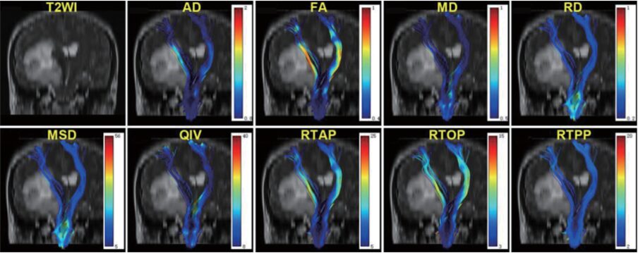 DXI: A Powerful Tool for Clinical Research in Advanced Diffusion Models