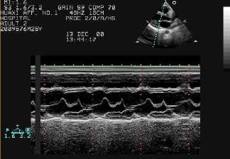 Research on Medical Ultrasound Diagnostic Equipment Industry