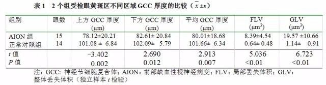 Assessment of GCC and RNFL Thickness in AION Diagnosis
