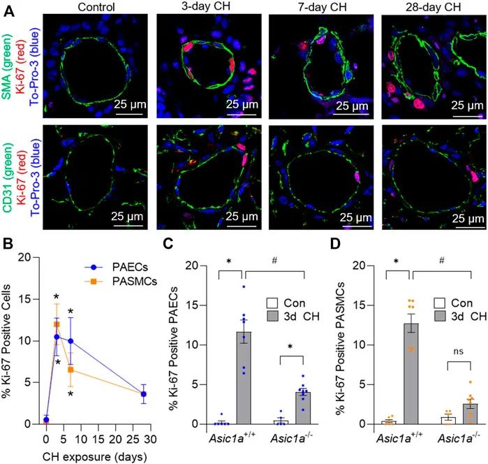 Smooth Muscle Acid-Sensing Ion Channel 1a as a Therapeutic Target to Reverse Hypoxic Pulmonary Hypertension