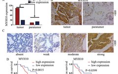 New Predictive Factors for Poor Prognosis in SOC