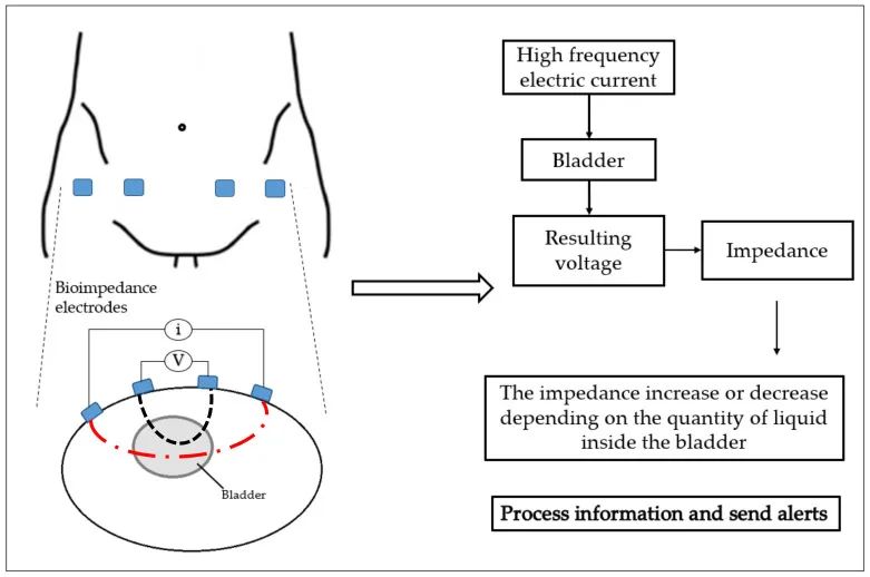Recent Advances in Non-Invasive Bladder Monitoring Technologies