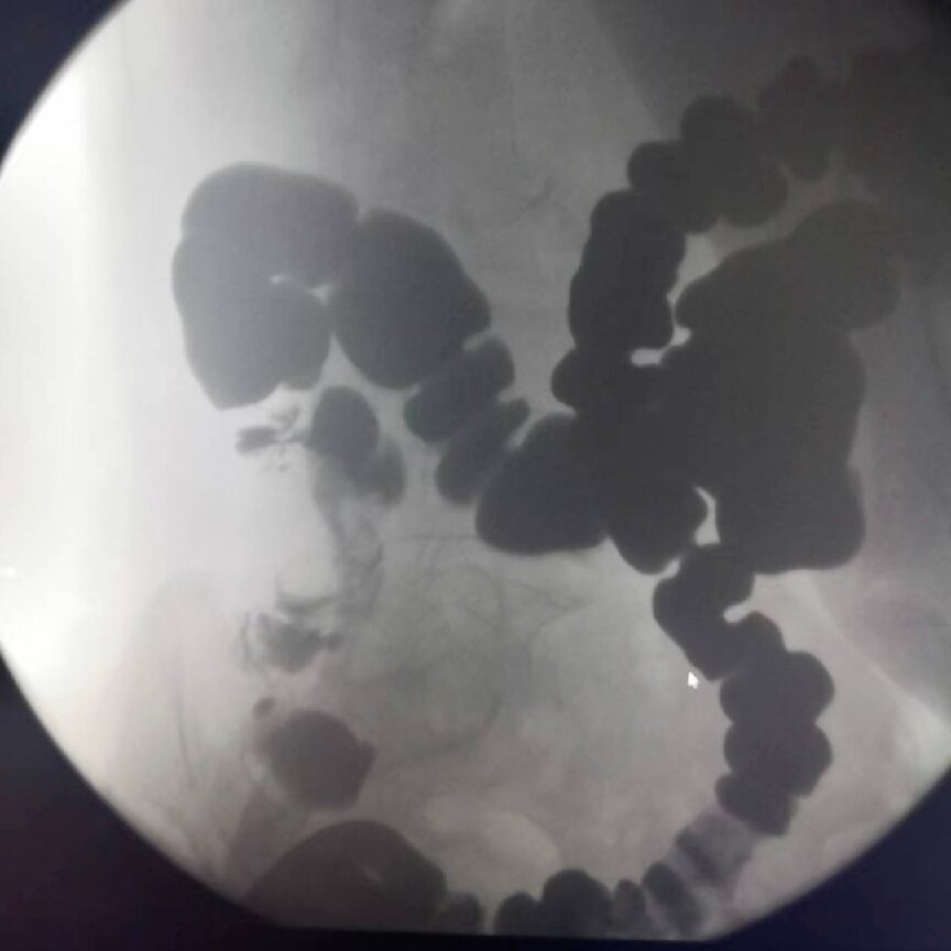 Clinical Use of Digital Gastrointestinal Imaging Equipment