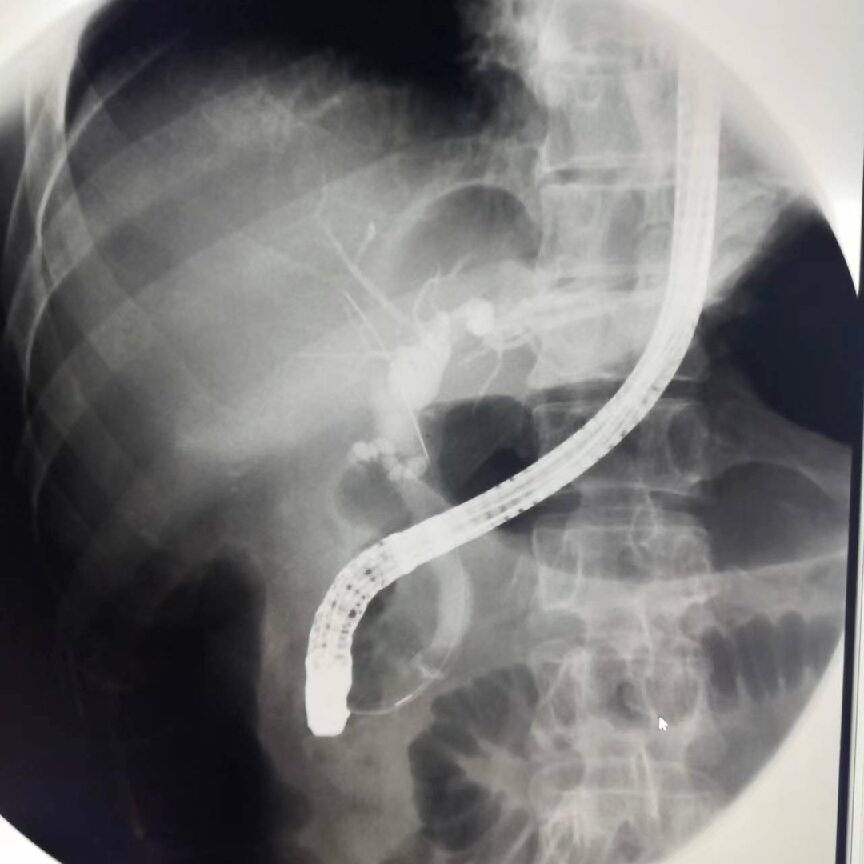 Clinical Use of Digital Gastrointestinal Imaging Equipment