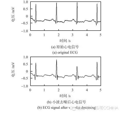How to Solve the Miniaturization of ECG Monitors