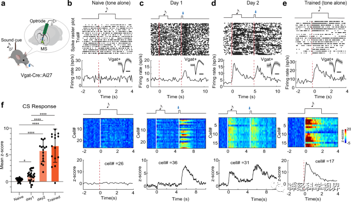 Scientists Reveal Reward Learning Pathway Mediated by Somatostatin Neurons