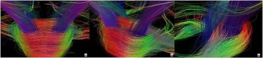 Understanding Q-Space Imaging in Diffusion MRI
