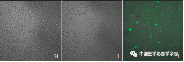 Inhibition of Breast Cancer Cells by Novel Nanoparticles Combined with Low-Intensity Focused Ultrasound