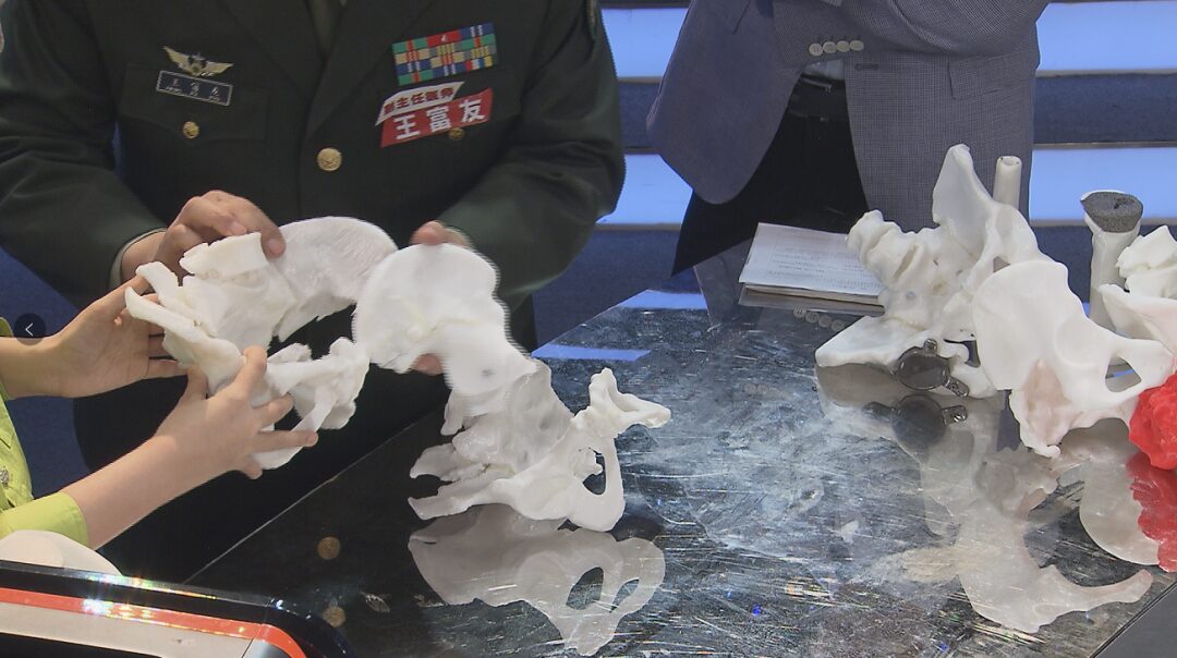 3D Printing: Regenerating Bones