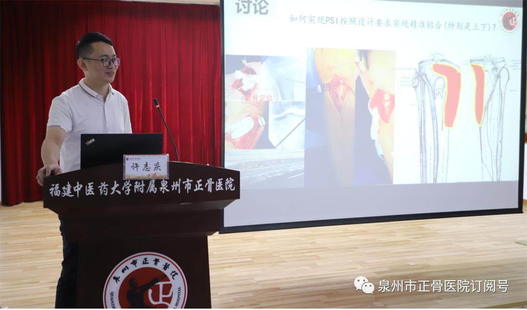3D Printing Technology for Precise Treatment of Severe Fractures