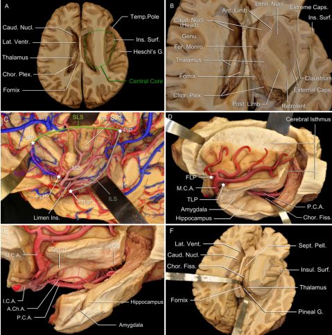 The Anatomical Significance of Brain White Matter Tracts