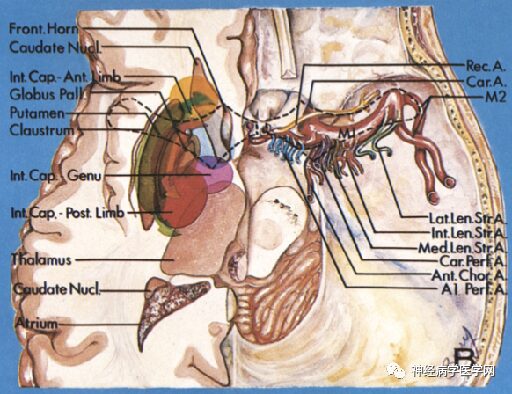 Types of Infarction in Perforating Artery Disease and Advances in Neuroimaging Research