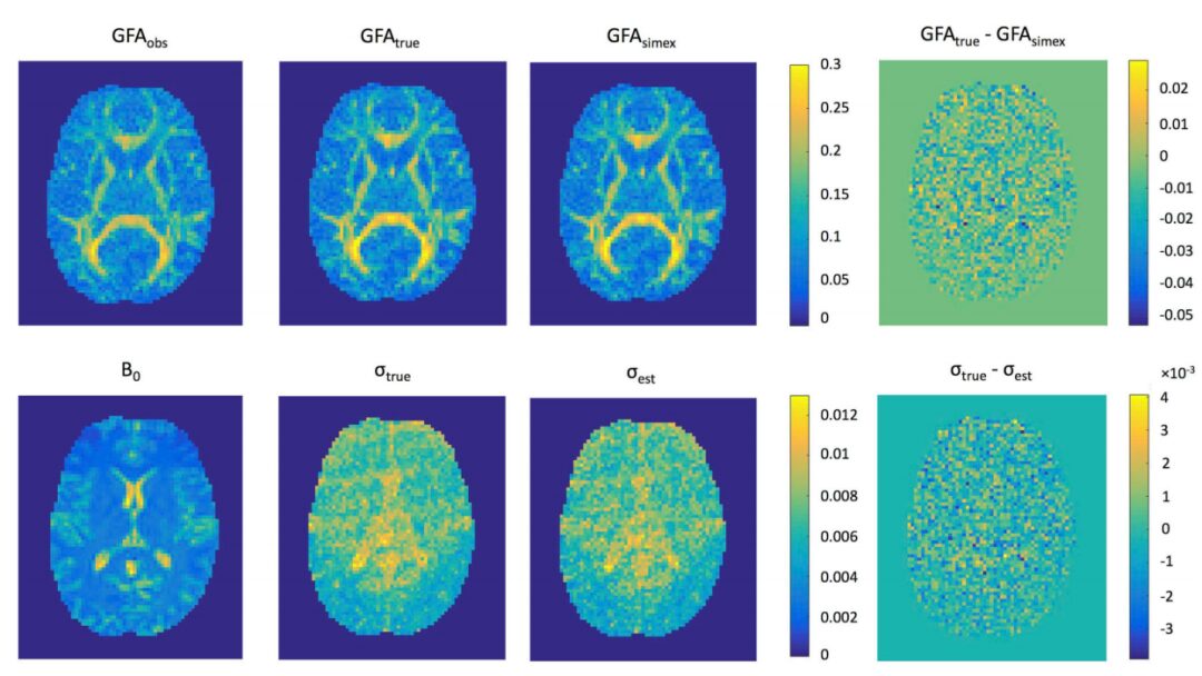 High-Order Diffusion Models in MRI