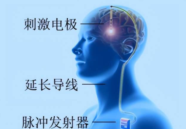 Understanding Meige Syndrome: Clinical Treatments and Differences from Facial Spasms