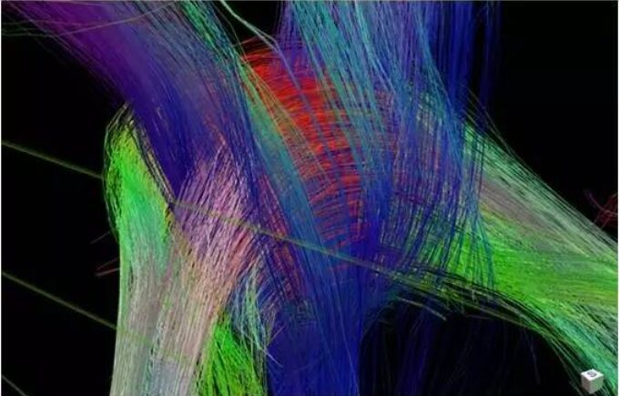 High-Order Diffusion Models in MRI