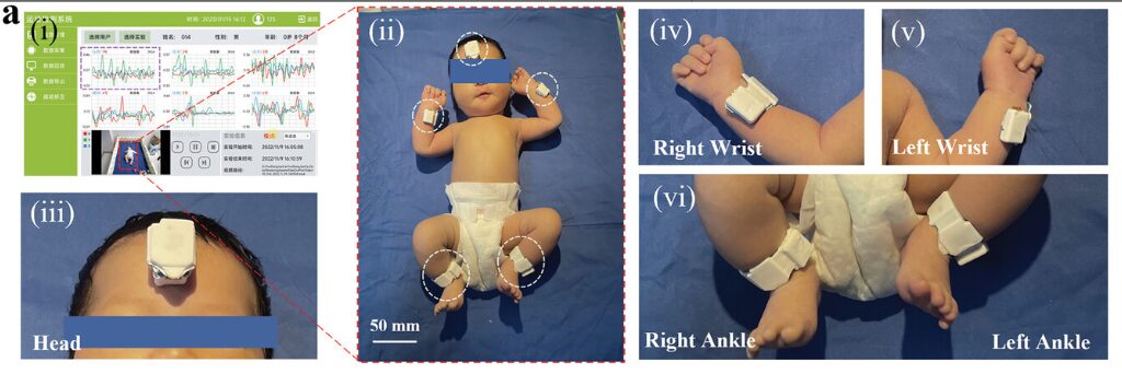 Flexible Intelligent Sparse Sensor Network for Infant Movement Assessment