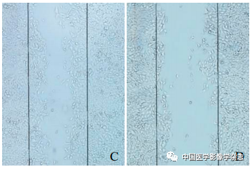 Inhibition of Breast Cancer Cells by Novel Nanoparticles Combined with Low-Intensity Focused Ultrasound