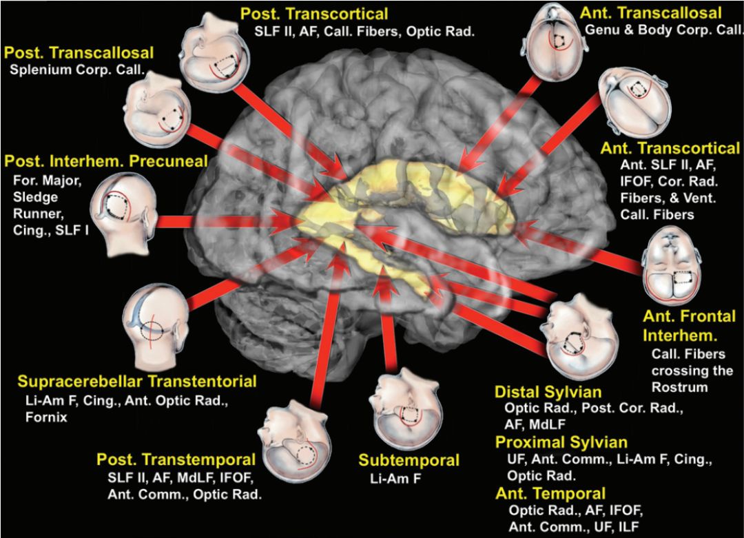The Anatomical Significance of Brain White Matter Tracts