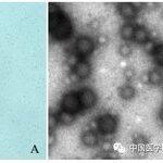 Inhibition of Breast Cancer Cells by Novel Nanoparticles Combined with Low-Intensity Focused Ultrasound