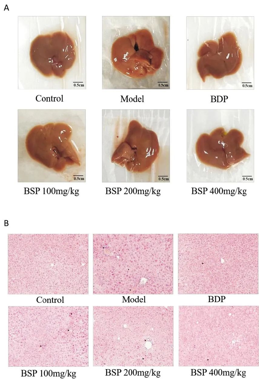 Study on the Role and Mechanism of Bletilla Striata Polysaccharide in LPS-Induced Acute Liver Injury in Mice
