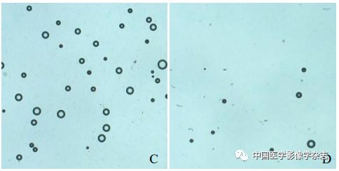 Inhibition of Breast Cancer Cells by Novel Nanoparticles Combined with Low-Intensity Focused Ultrasound