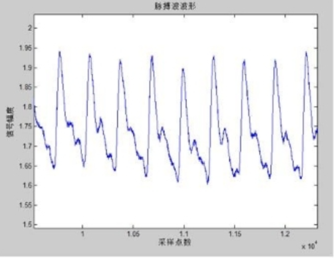 STM32 Microcontroller Smart Bracelet Heart Rate Pedometer Temperature