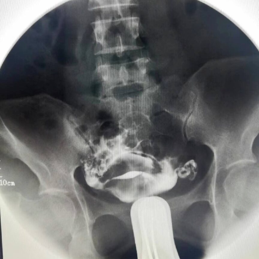 Clinical Use of Digital Gastrointestinal Imaging Equipment