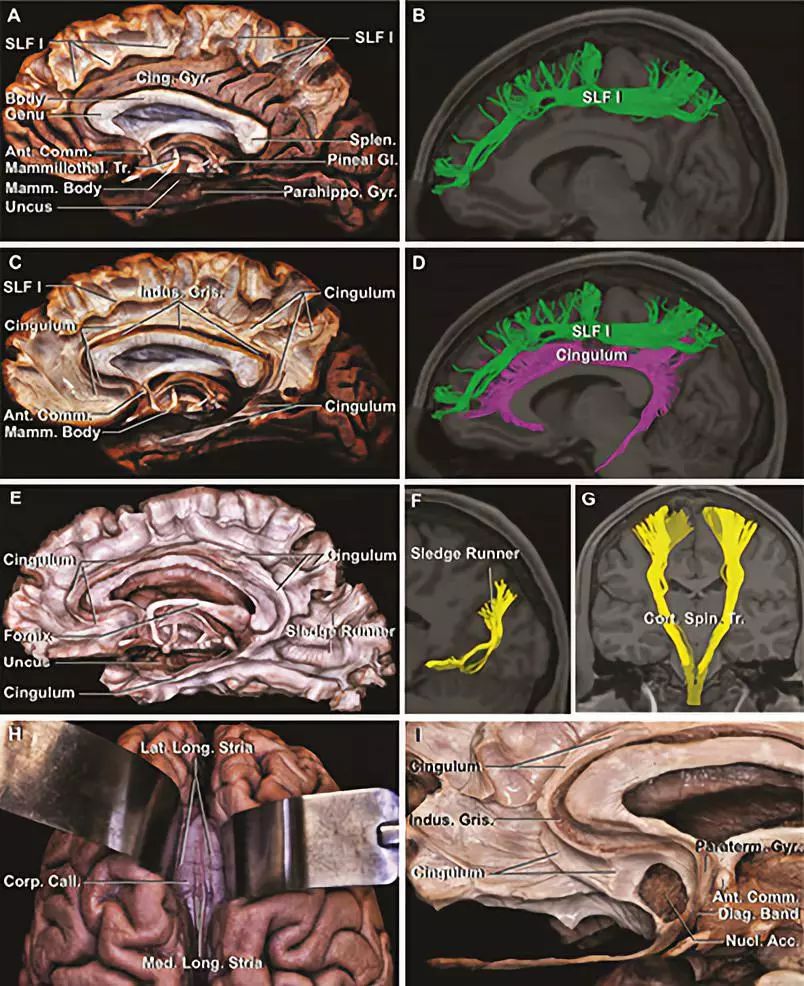 The Anatomical Significance of Brain White Matter Tracts