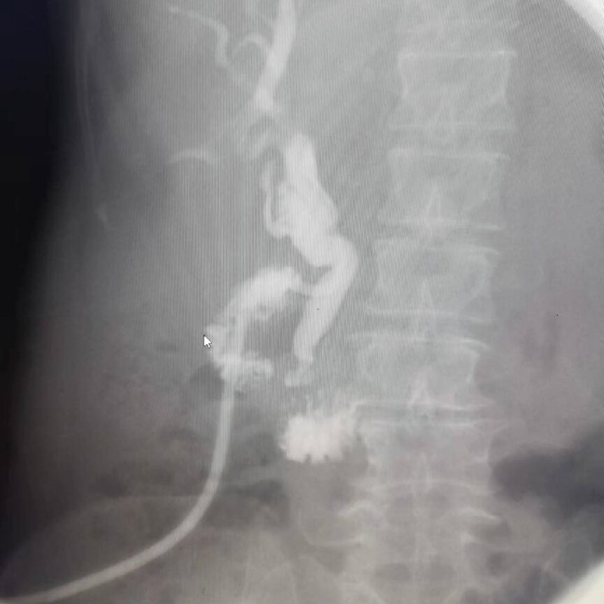 Clinical Use of Digital Gastrointestinal Imaging Equipment