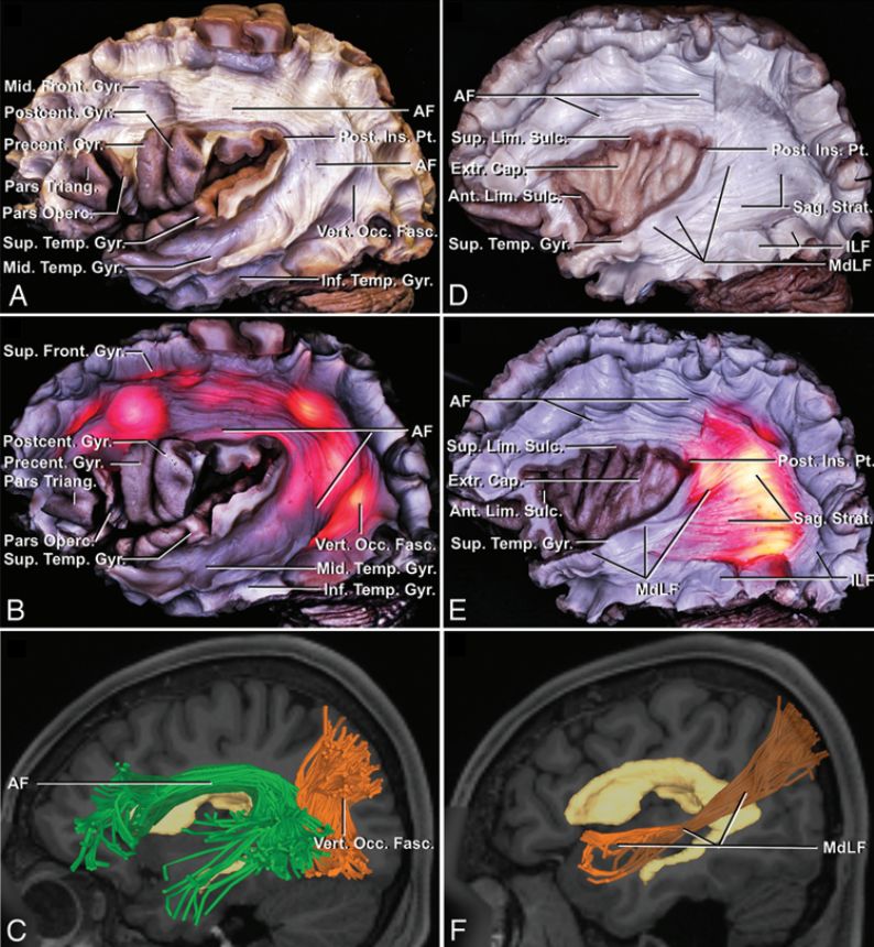 The Anatomical Significance of Brain White Matter Tracts