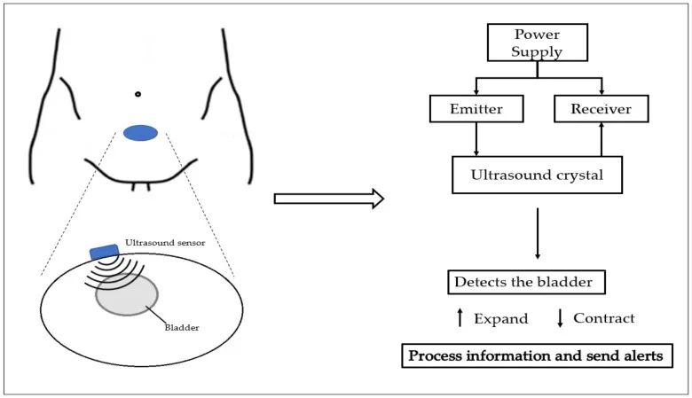 Recent Advances in Non-Invasive Bladder Monitoring Technologies