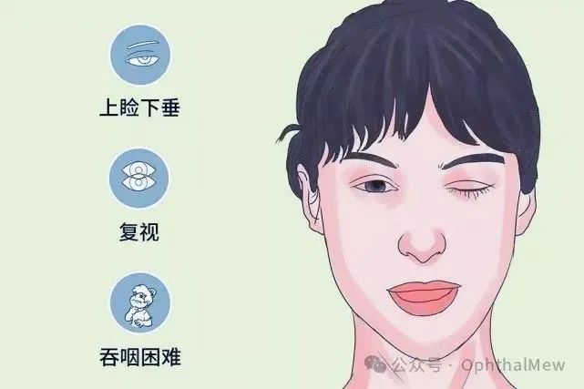 Understanding Eyelid Spasms and Their Treatment