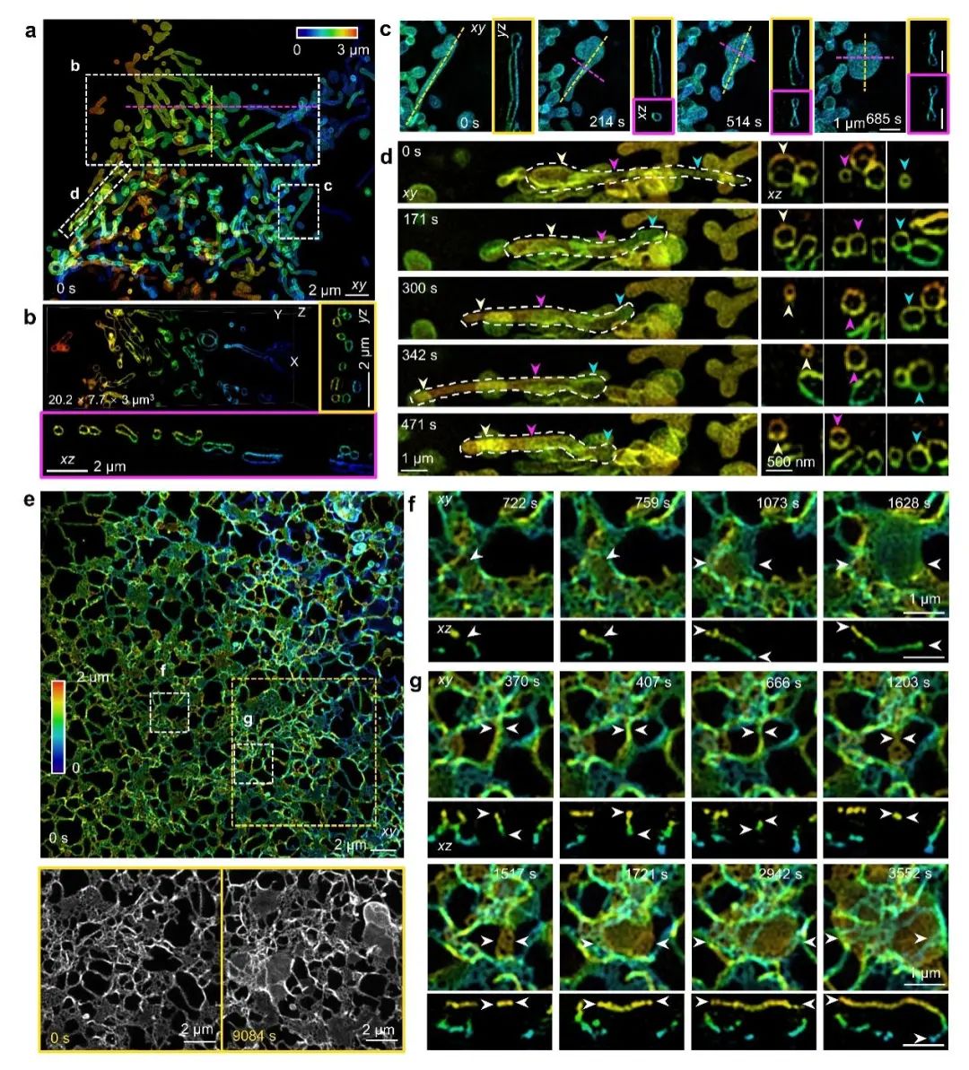4Pi-SIM Imaging Technology for Live Cell 3D Resolution