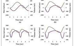 Quantitative Testing of Nebulizer Delivery Efficiency Under Different Breathing Patterns