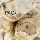 Study of the Superior Frontal Gyrus and Its White Matter Connections