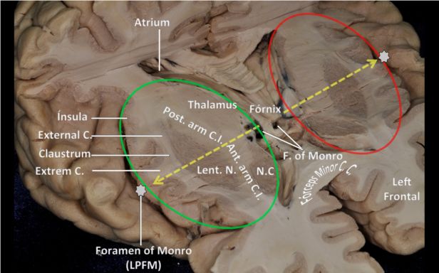 The Anatomical Significance of Brain White Matter Tracts