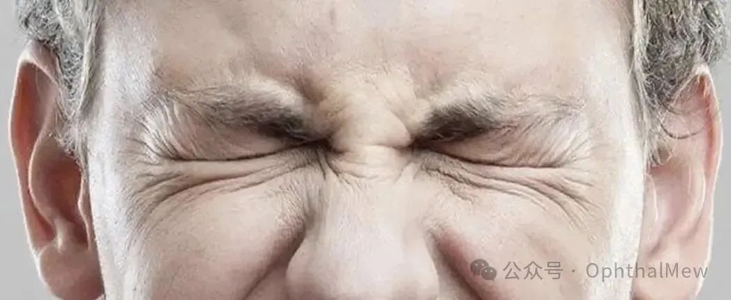 Understanding Eyelid Spasms and Their Treatment