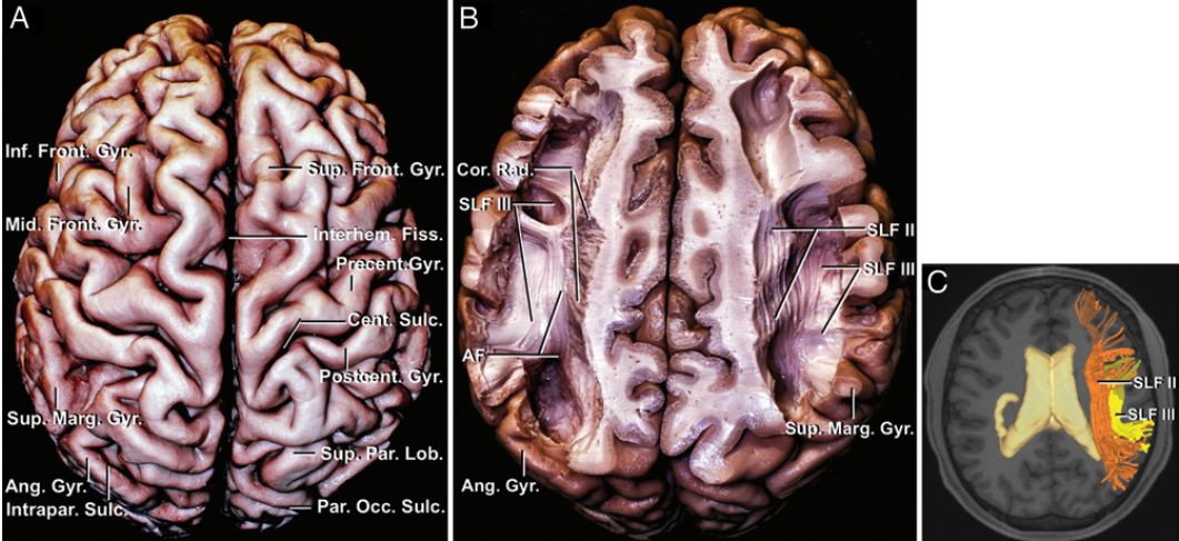 The Anatomical Significance of Brain White Matter Tracts