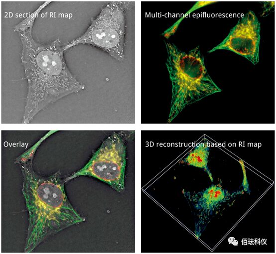 Monitoring Pyroptosis in B16 Cells Using Holographic 3D Imaging