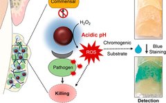 Ferumoxytol Nanoparticles Target Biofilms Causing Tooth Decay