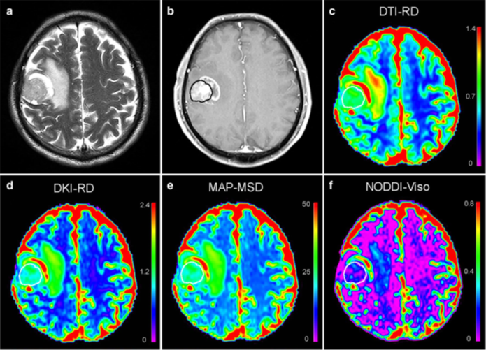 DXI: A Powerful Tool for Clinical Research in Advanced Diffusion Models